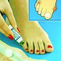 Corn Cure Stick